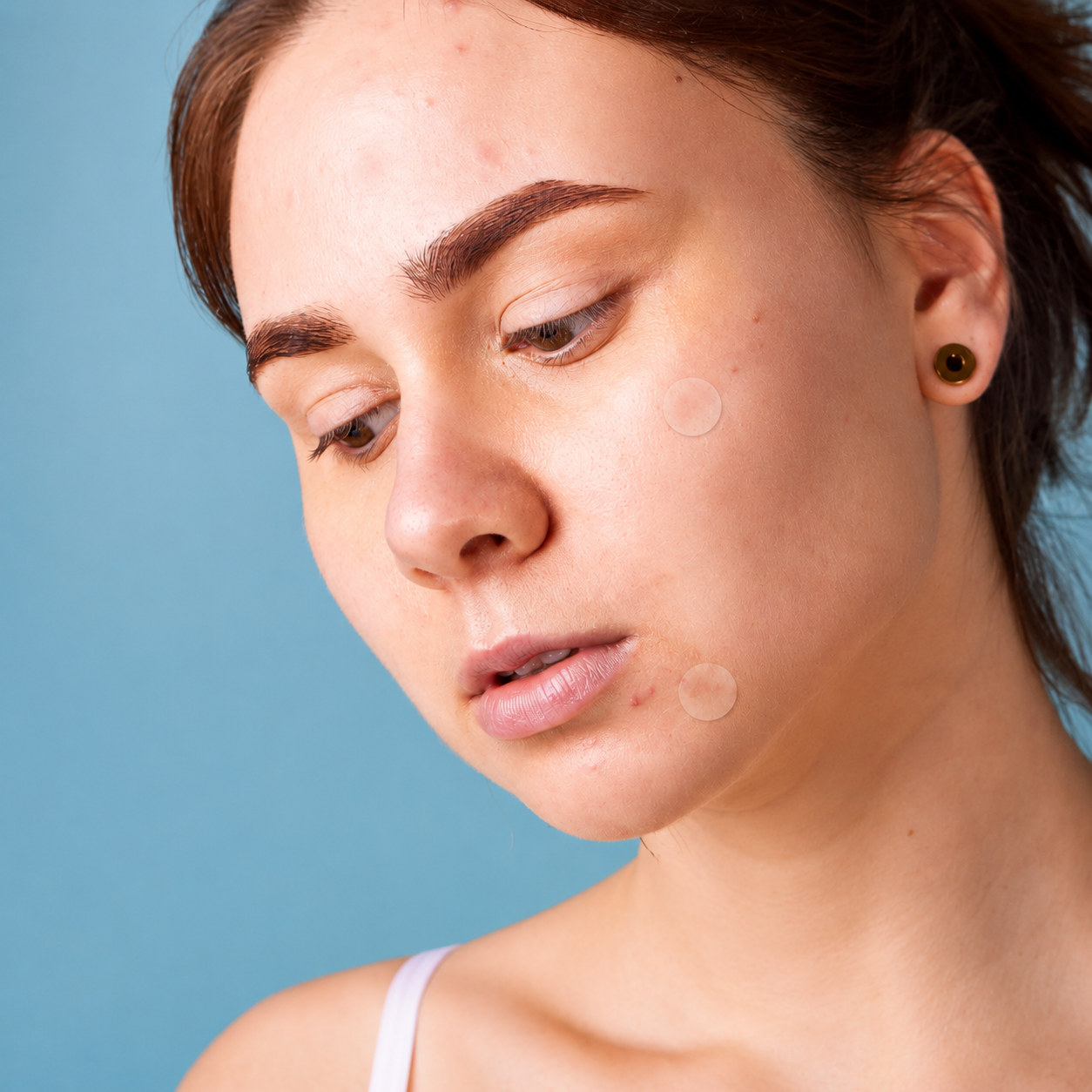 Hydrocolloid Acne Patches | Invisible Spot Stickers | Lupetal